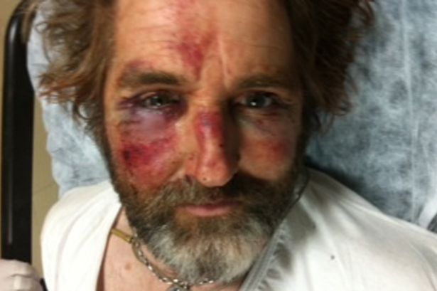 Anthony Lloyd var illa farinn eftir meðferðina hjá uppreisnarmönnunum.