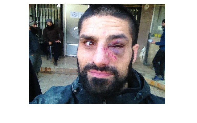 EIns og sjá má ber Kahja greinileg merki misþyrminga.